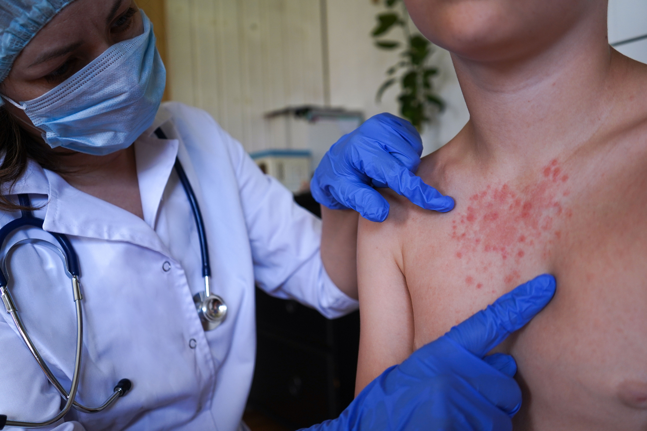 Lead image for Measles warning in Australia highlights critical role of community pharmacy vaccination services